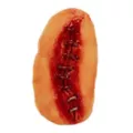 Metal Suture Appliance at Spencer's