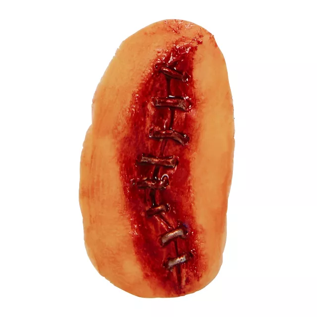 Metal Suture Appliance at Spencer's