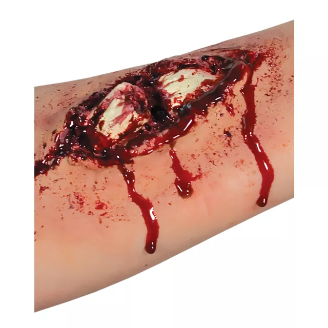 Broken Bone Appliance Kit at Spirit Halloween